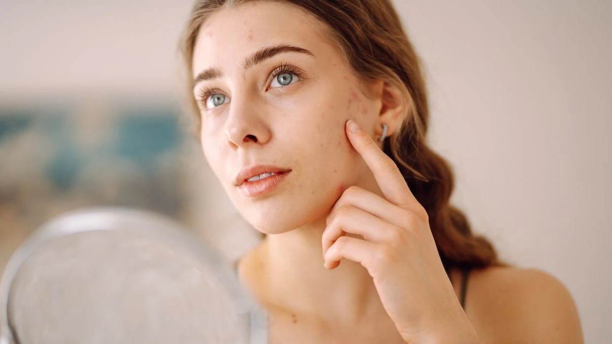 Cilt lekelerini azaltan doğal maske! Evde yapabilirsiniz