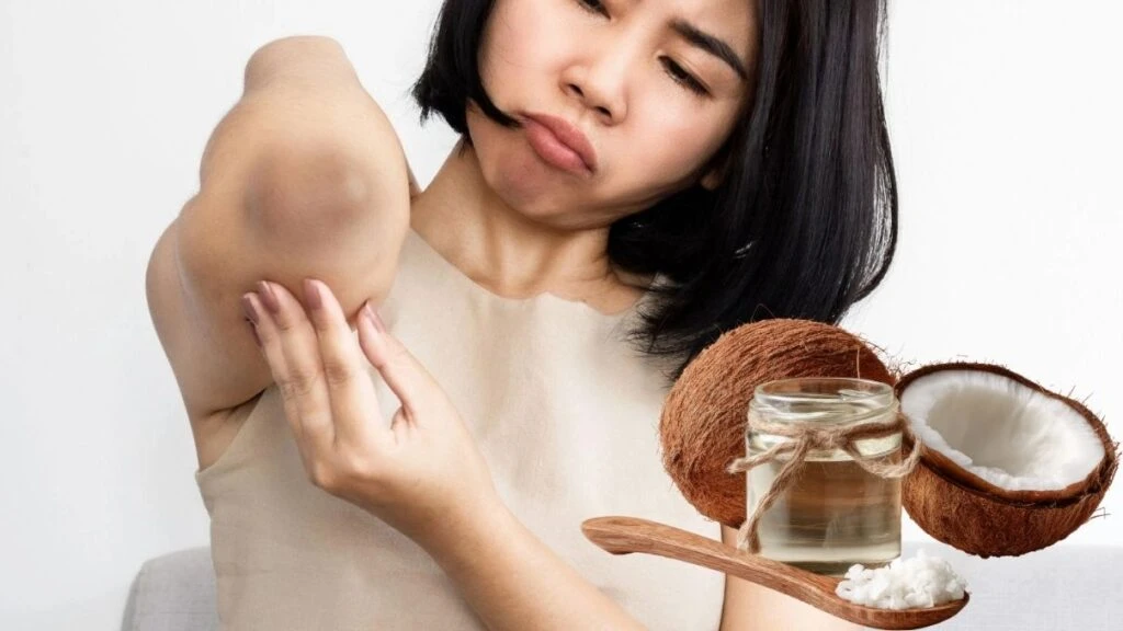 Diz ve dirsek kararmalarına evde çözüm! Toz şeker ve Hindistan cevizi yağı