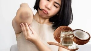 Diz ve dirsek kararmalarına evde çözüm!