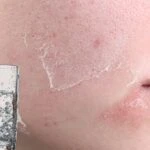 Susuz kalan cilt için iftarda tüketilmesi gereken besinler! Döküntü kaşıntı artıyor