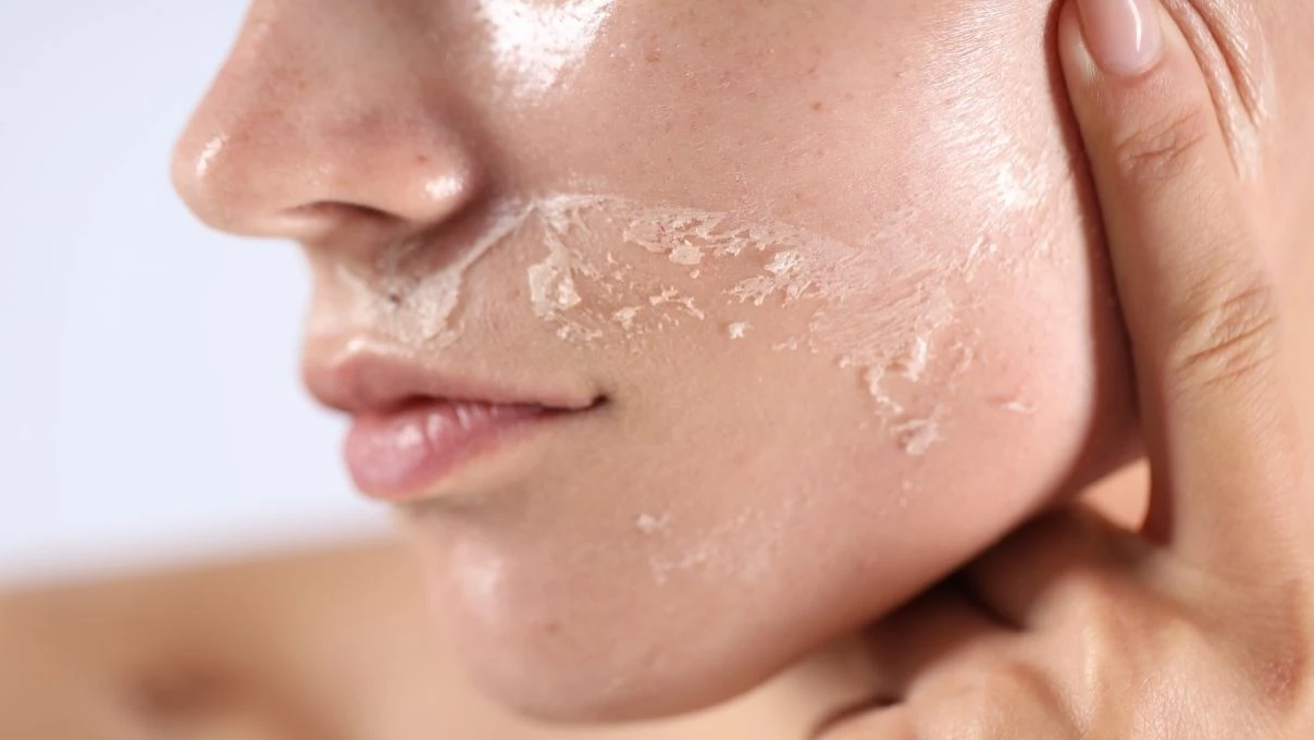 Susuz kalan cilt için iftarda tüketilmesi gereken besinler! Döküntü kaşıntı artıyor