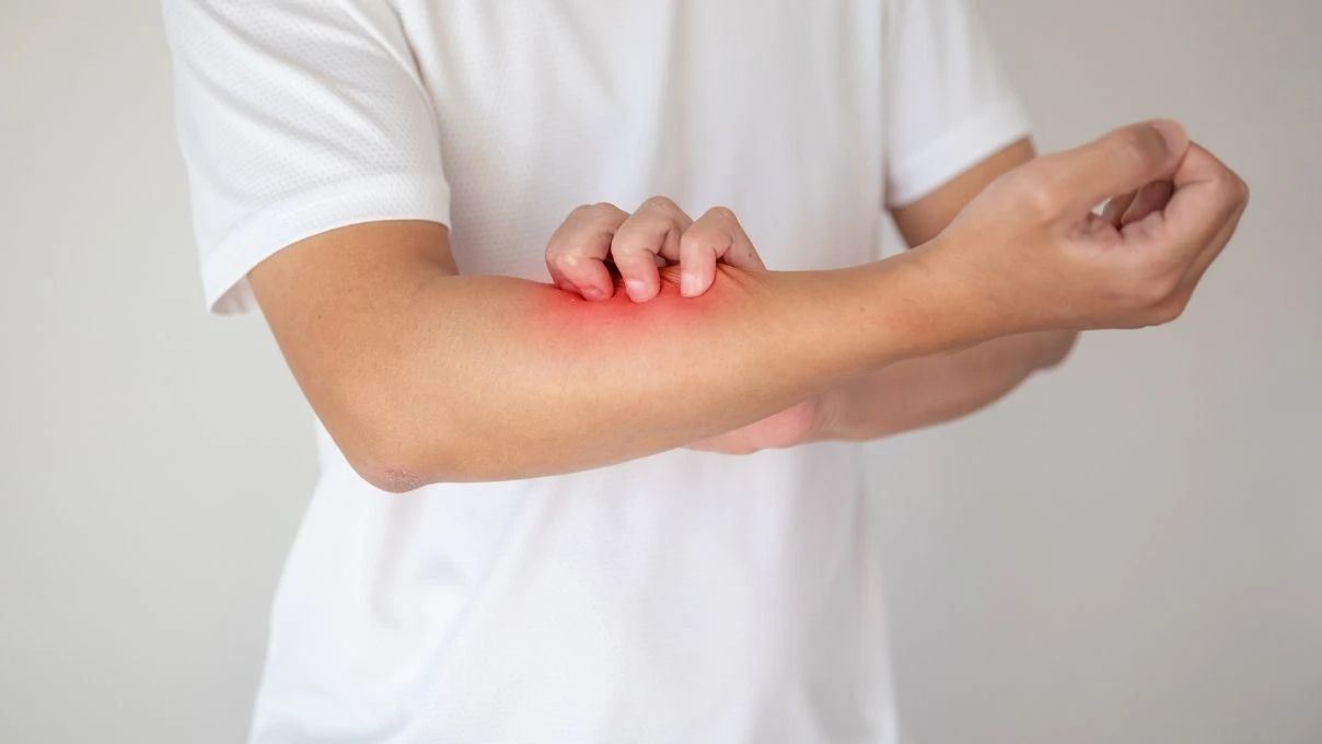 Susuz kalan cilt için iftarda tüketilmesi gereken besinler! Döküntü kaşıntı artıyor