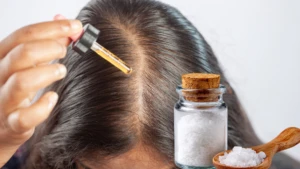 Yağlı saçlara son!