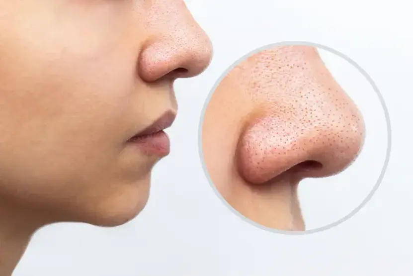 66a3dfc92a36a3daf145a17e