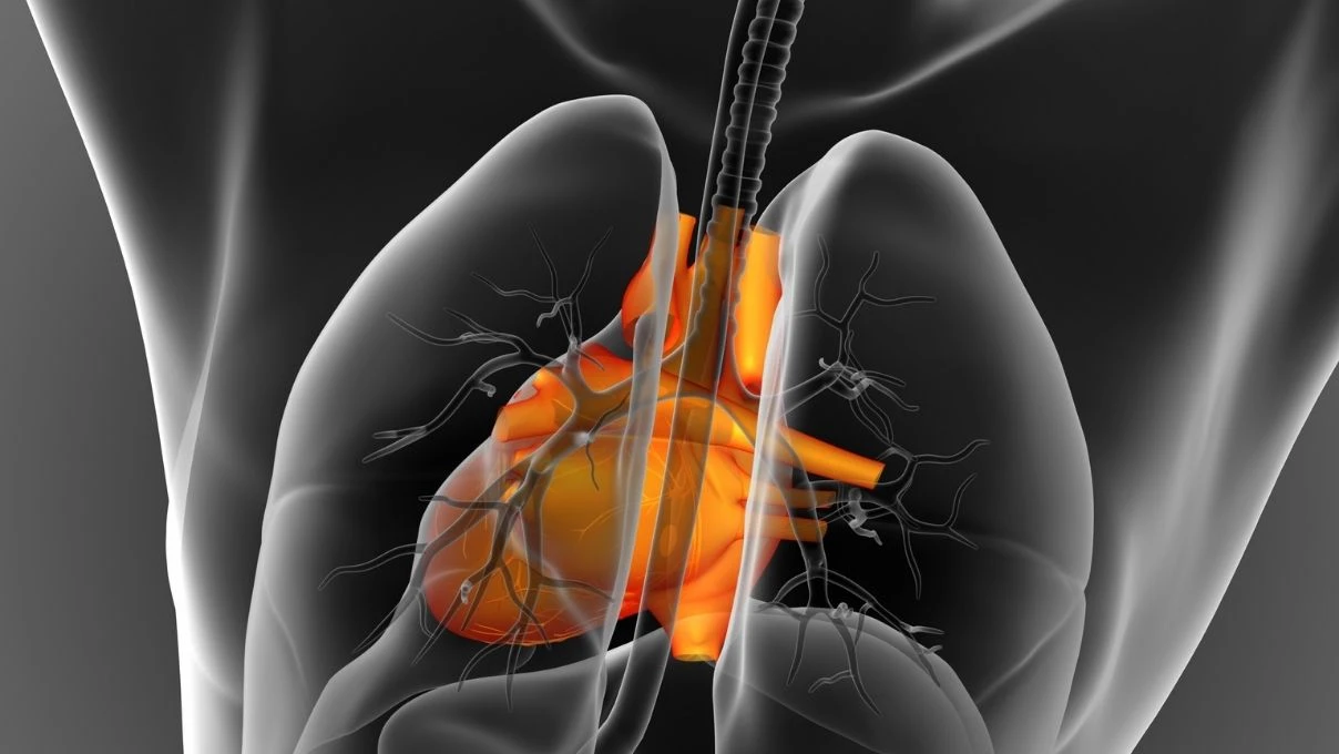 Aort damarı yırtılması sonucu vefat eden Eşref Rüya oyuncusu Ramazan Tetik'le yeniden gündem oldu! Aort damarı neden yırtılır: Uzmanlardan uyarı