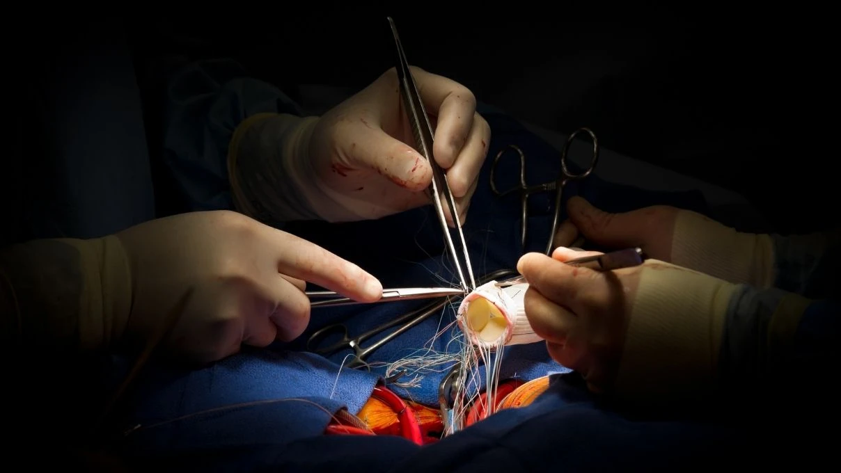 Aort damarı yırtılması sonucu vefat eden Eşref Rüya oyuncusu Ramazan Tetik'le yeniden gündem oldu! Aort damarı neden yırtılır: Uzmanlardan uyarı