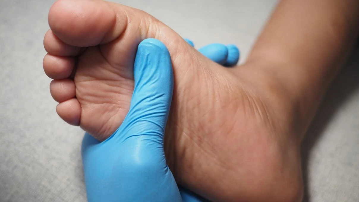 Çorap çıkartırken bileklerdeki izlere dikkat! Vücudunuz su tutuyor