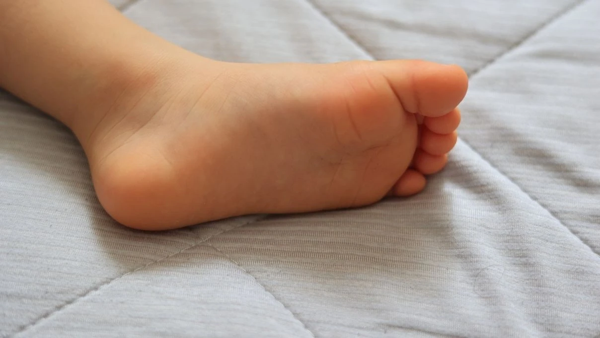 Çorap çıkartırken bileklerdeki izlere dikkat! Vücudunuz su tutuyor