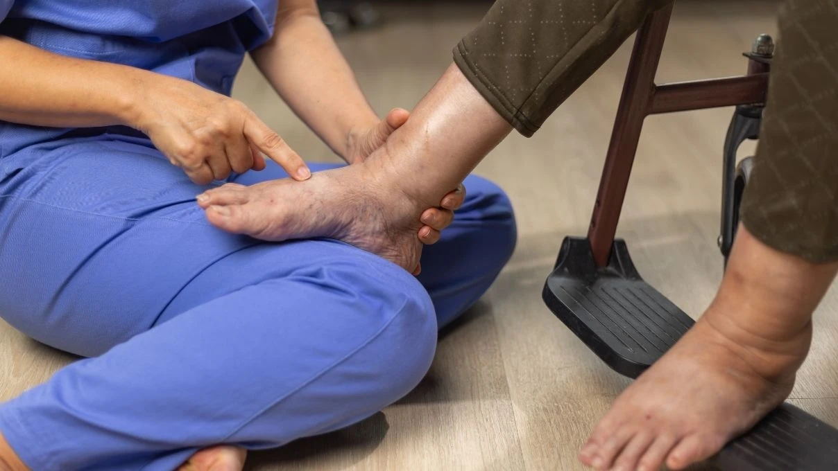 Ödem atan 7 besin! Kilolu değilsiniz şişkinsiniz