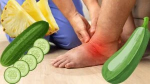 Kilolu değilsiniz şişkinsiniz!