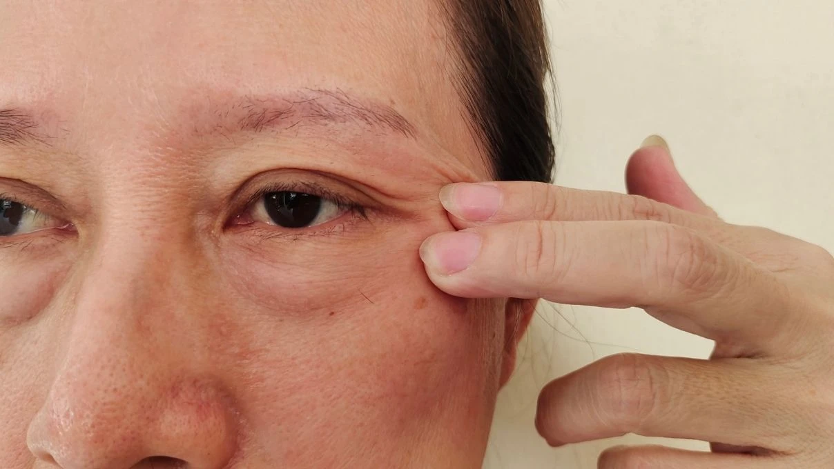 Kırışıklık azaltan doğal yöntemler! Tonlarca para vermeyin, İbn-i Sina’nın asırlık tarifi