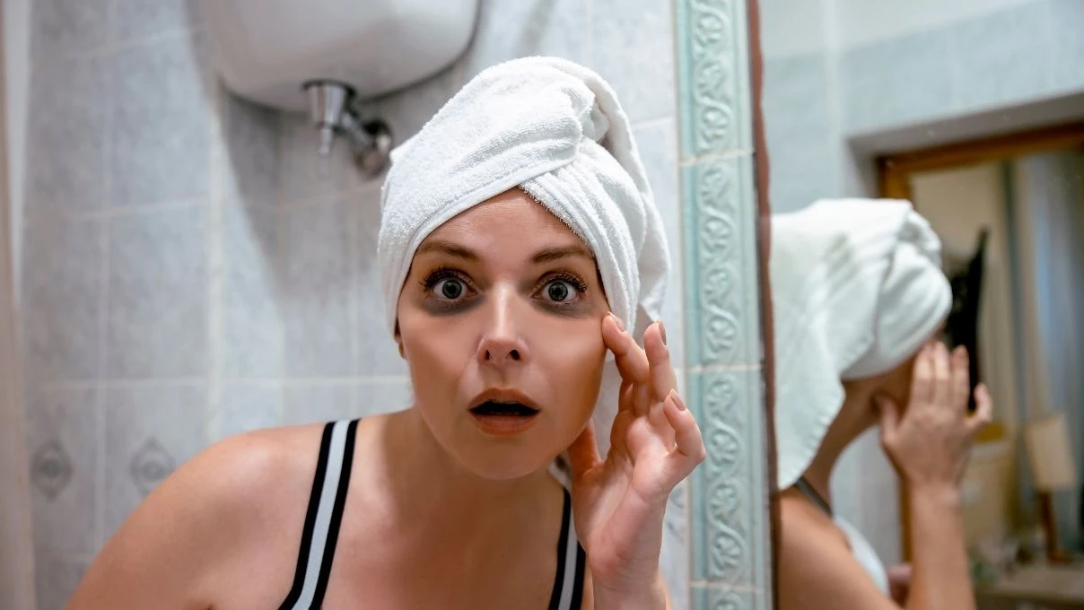 Canan Karatay'dan göz altı morluklarına net çözüm! Peki göz altı morlukları neden olur? 