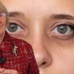 Canan Karatay'dan göz altı morluklarına net çözüm! Peki göz altı morlukları neden olur?