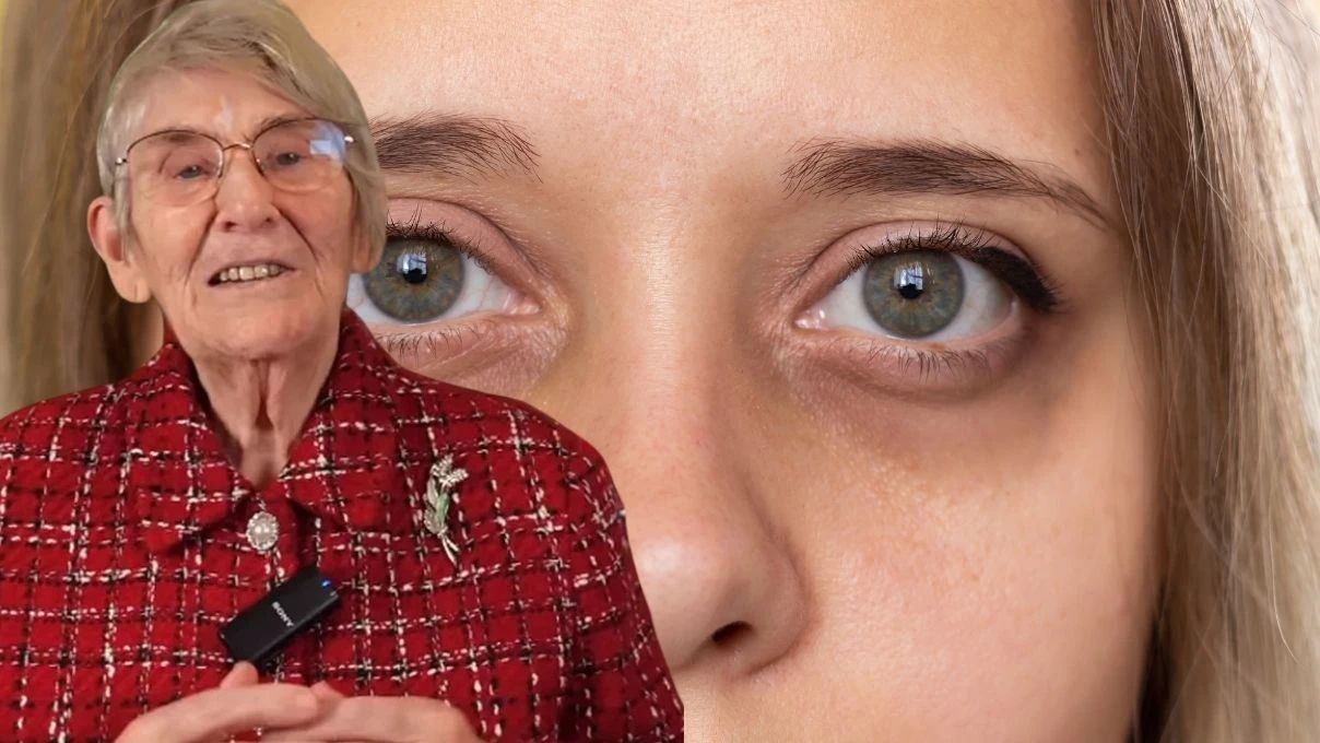 Canan Karatay'dan göz altı morluklarına net çözüm! Peki göz altı morlukları neden olur?