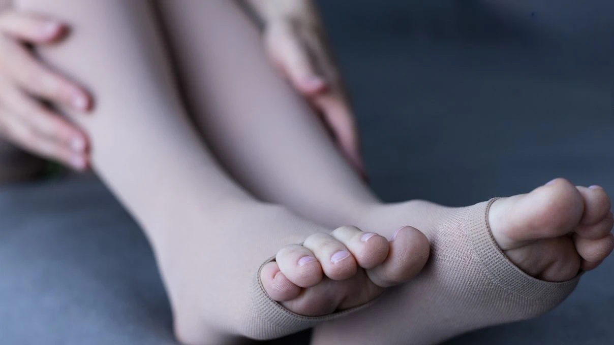 Kadınlarda ayak şişmesi neyin habercisi! Çorap izi çıkıyorsa aman dikkat 