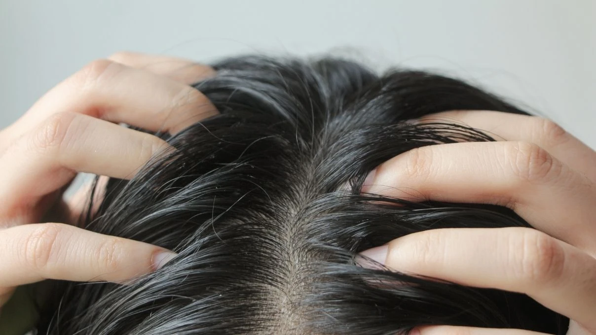 İnce telli saçlar neden çabuk yağlanır? Yağlı saçlar için muhteşem maske!