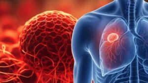 Kanser alarmına dikkat! Vücudunuz sinyal veriyor