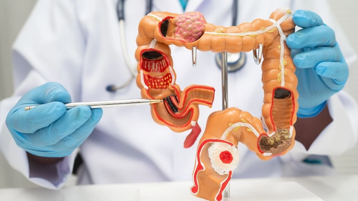 Sabah aç karnına tüketin! Bağırsakları yumuşatan tarif