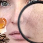 Burun ve yanaklardaki gözenekleri küçücük yapacak karışım! 30 yaşından önce başlayın