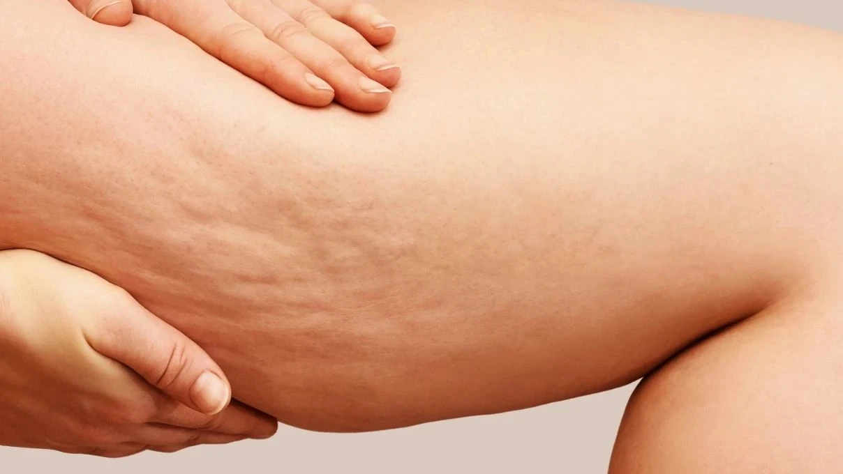 Duşta gelen güzellik! Hindistan cevizi yağıyla sarkmalardan, selülitlerden kurtulun 4 Duşta gelen güzellik! Hindistan cevizi yağıyla sarkmalardan, selülitlerden kurtulun