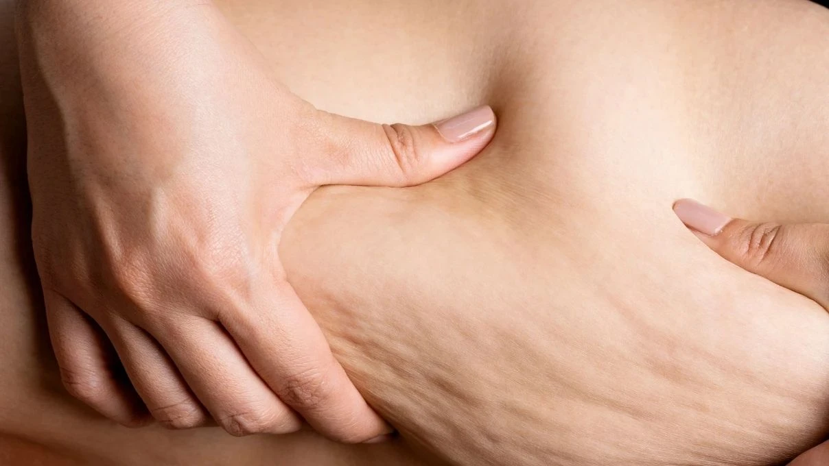 Duşta gelen güzellik! Hindistan cevizi yağıyla sarkmalardan, selülitlerden kurtulun 5 Duşta gelen güzellik! Hindistan cevizi yağıyla sarkmalardan, selülitlerden kurtulun