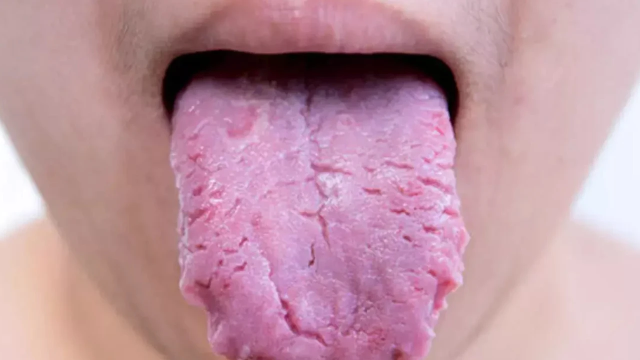 5 526