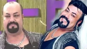 933 kobra murat kel mi saci peruk mu protez sac mi kullaniyor