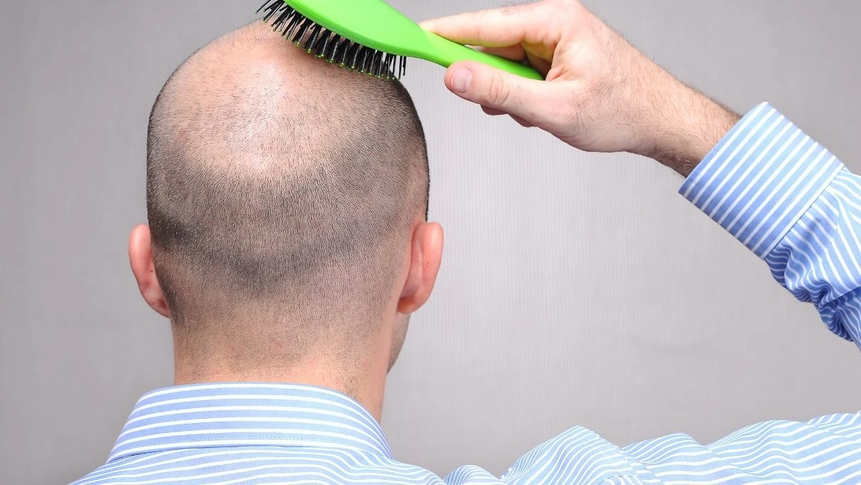Sadece bir haftada saç gürleştiren serum! İbni Sina asırlar yıl önce verdiği tarif	