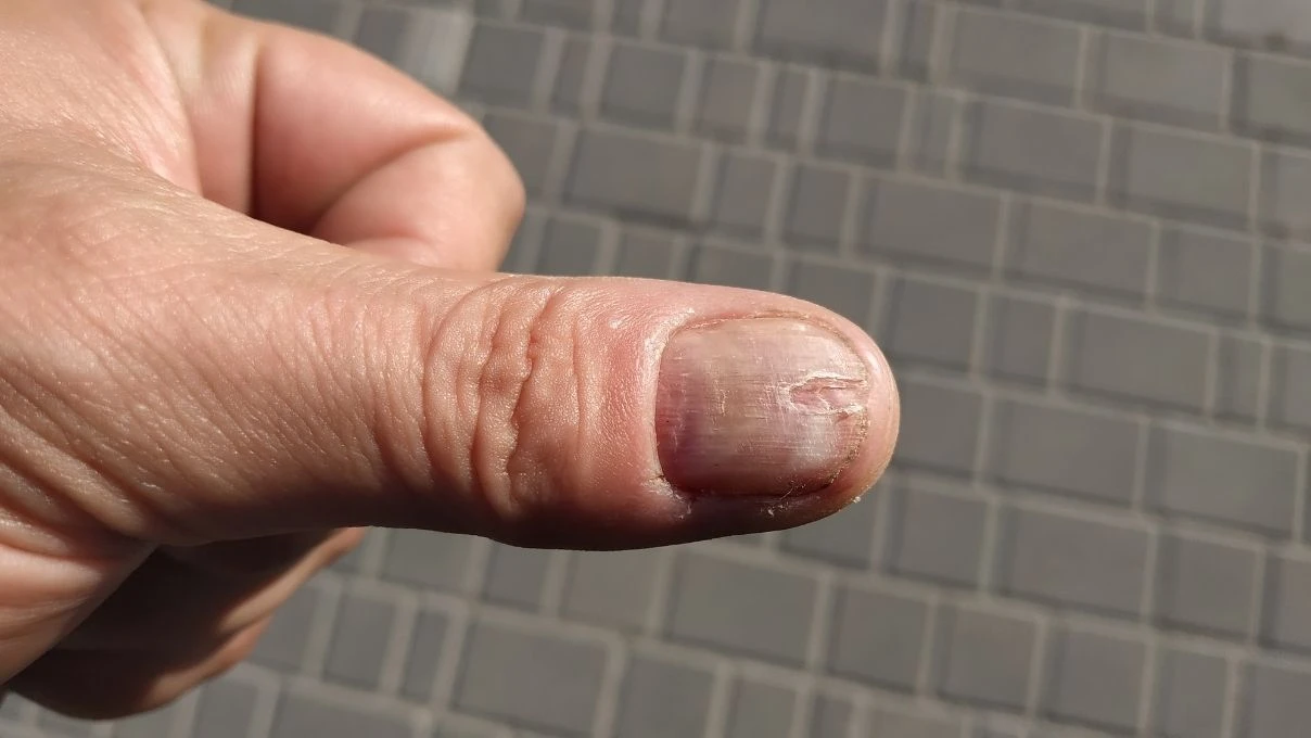 Bunu duyan eczaneye koşacak! Tırnakları güçlendiren doğal çözüm
