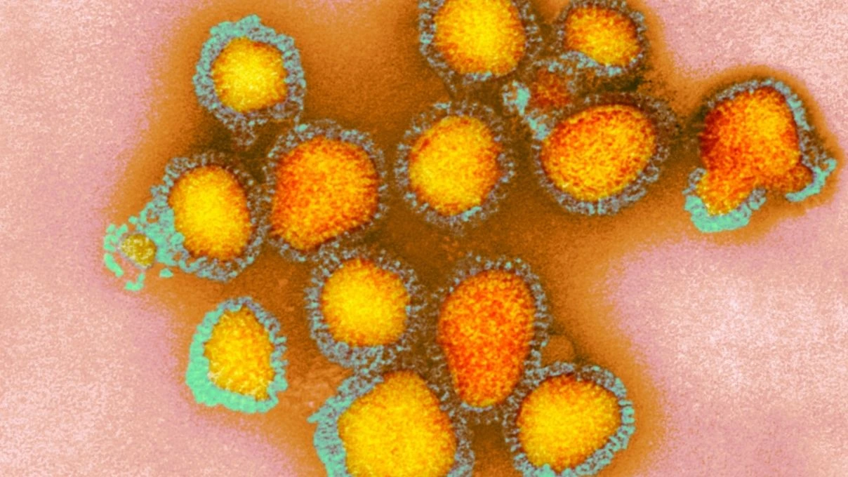 H3N2 virüsü neden bu kadar hızlı yayılıyor? H3N2 virüsü gripten farklı mı? 4 H3N2 virüsü neden bu kadar hızlı yayılıyor? H3N2 virüsü gripten farklı mı?