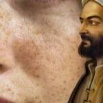 Güneş lekelerine İbn-i Sina yöntemi! Asla oluşmuyor