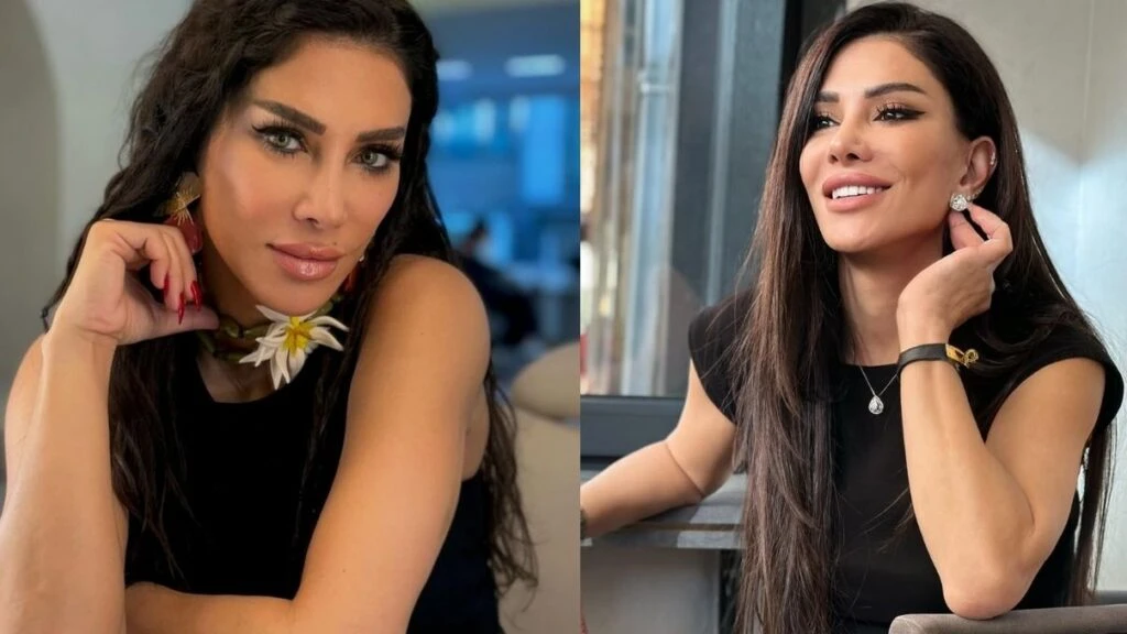 Ünlü güzellik uzmanı Emsal Doğan ameliyatla göz rengini değiştirdi! “Saç boyamak gibi”