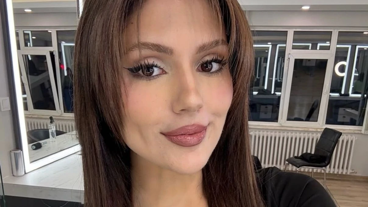 Kısmetse Olur Aybüke Çangal dolgularını eritti! Bambaşka biri oldu