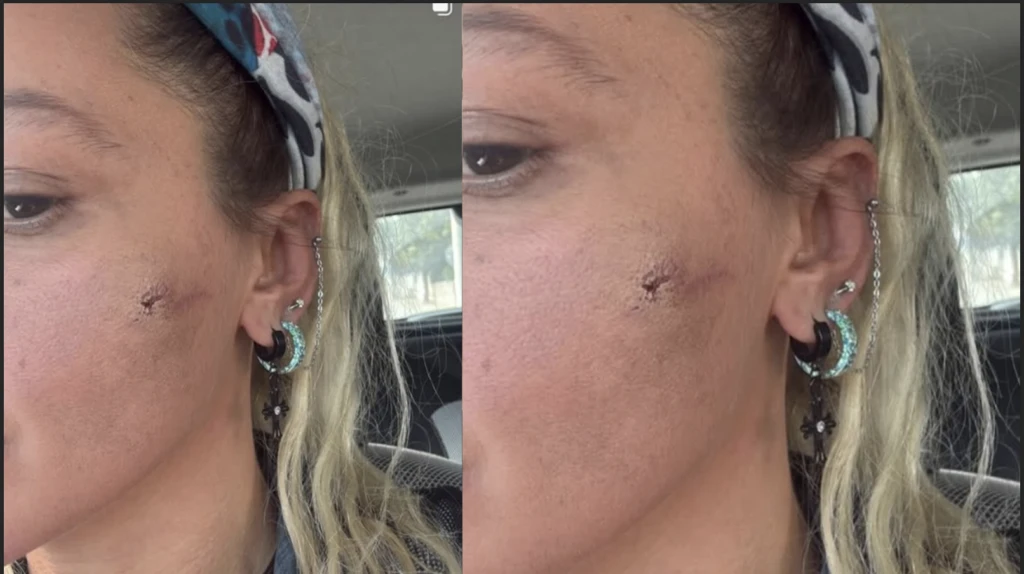 Yıldız Asyalı eşinden gördüğü şiddeti o fotoğrafla duyurdu! Sosyal medyayı ayağa kaldıran paylaşım 8 Ekran Resmi 2025 12 08 23.23.16