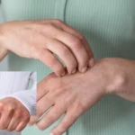 Ellerinizin kurumasinin nedeni ortaya cikti Hastalik belirtisi