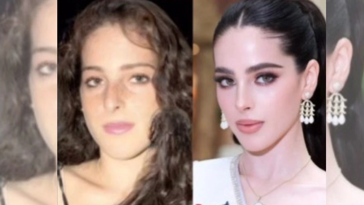 Kainat güzeli Fatima Bosch estetikli çıktı! Eski hali pes dedirtti 8 Kainat güzeli Fatima Bosch estetikli çıktı! Eski hali pes dedirtti