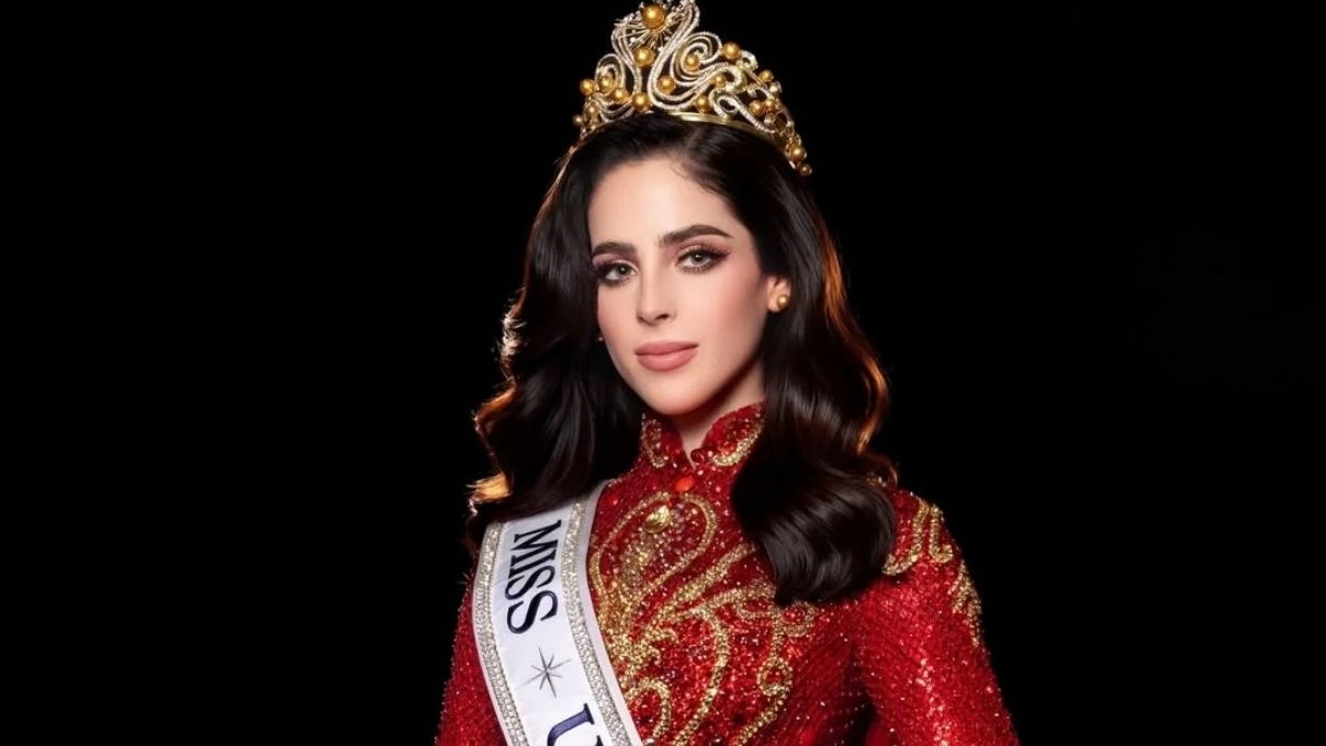 Kainat güzeli Fatima Bosch estetikli çıktı! Eski hali pes dedirtti 4 Kainat güzeli Fatima Bosch estetikli çıktı! Eski hali pes dedirtti