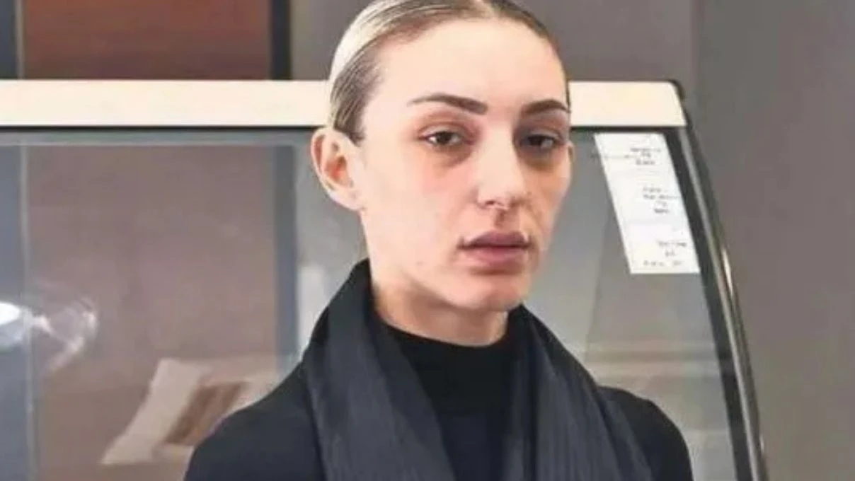 Bircan Dülger kimdir? Bircan Dülger Güllü'nün ölümüyle bağlantısı nedir?