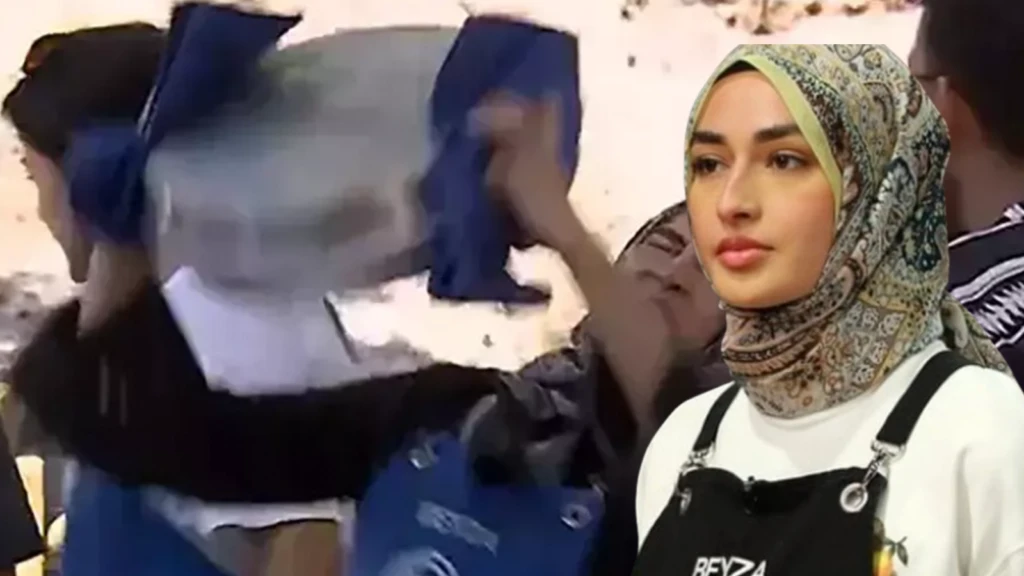 MasterChefte yuzu kizgin yag ile yanmisti Beyza nasil iyilestigini ilk kez acikladi