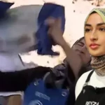 MasterChefte yuzu kizgin yag ile yanmisti Beyza nasil iyilestigini ilk kez acikladi