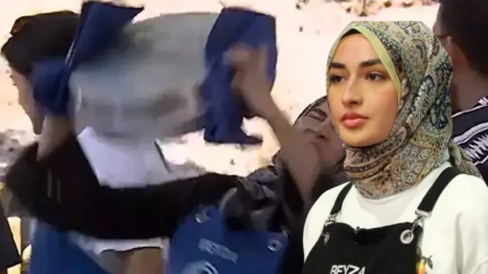 MasterChefte yuzu kizgin yag ile yanmisti Beyza nasil iyilestigini ilk kez acikladi