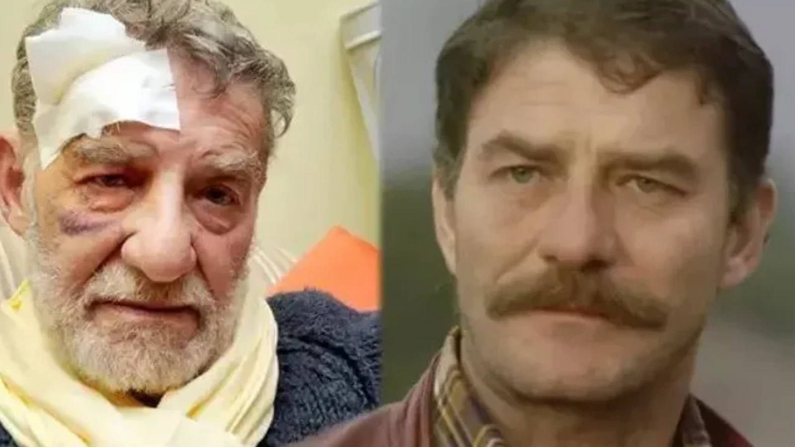 Parkta dusup kalca kemigini kirmisti Ahmet Mekinden saglik durumu hakkinda aciklama geldi