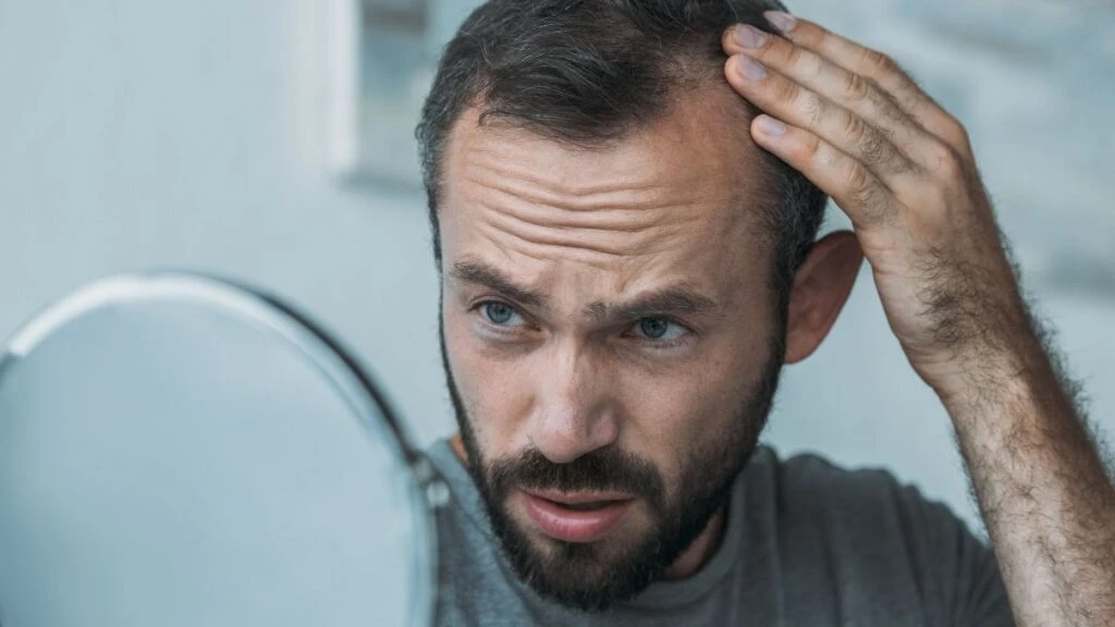 Saç dökülmelerinin asıl nedeni! Bilimsel destekli vitaminleri unutmayın