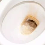 Sararmis klozet artik olmayacak Evde bu karisimla temizlik yapin