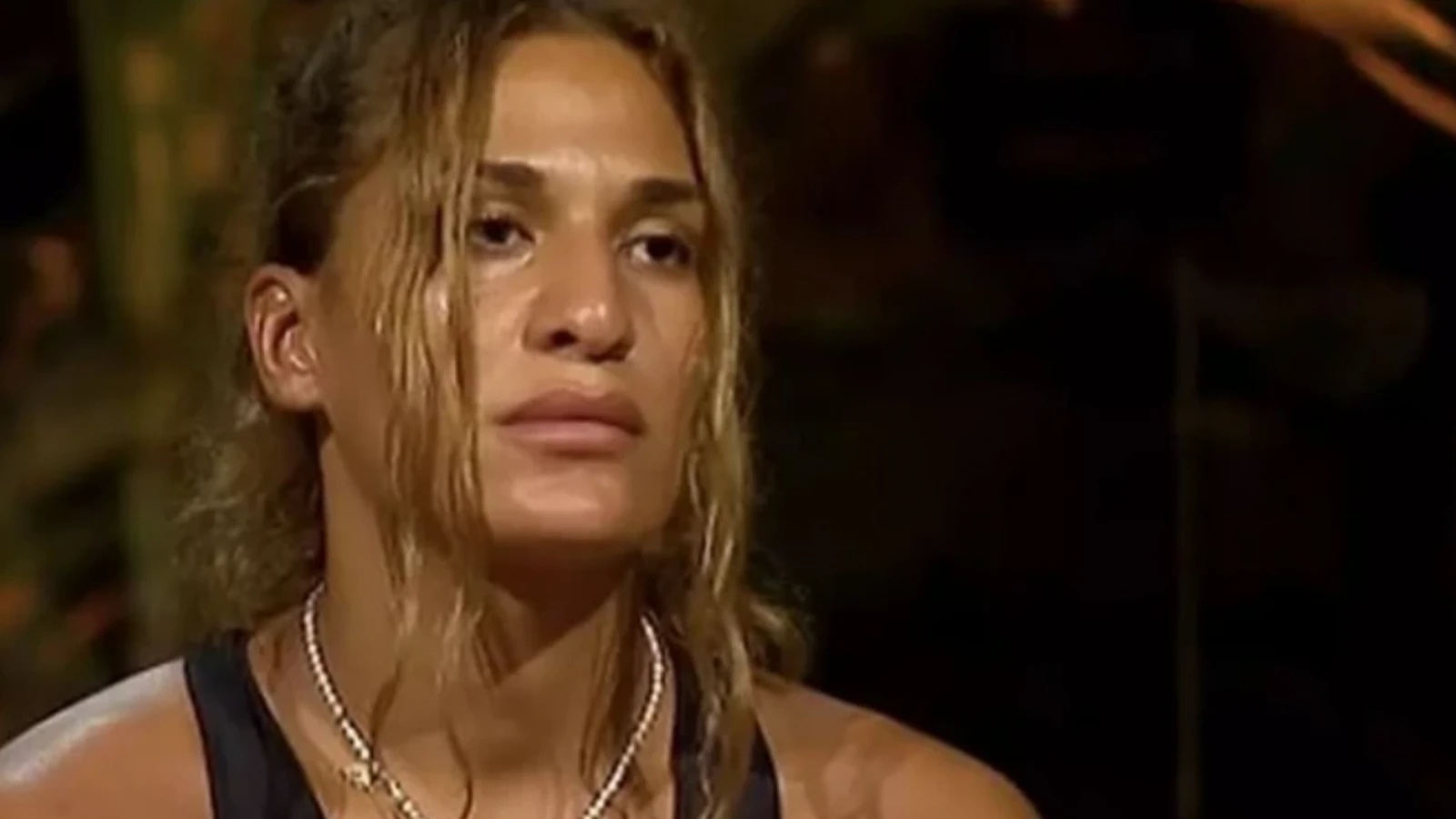 Survivor 2025 Almeda Baylandan korkutan haber Komaya mi girdi saglik durumu nasil