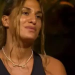 Survivor 2025 yarismacisi Almeda Baylan burun estetigi oldu Iste operasyon sonrasi ilk kare 1