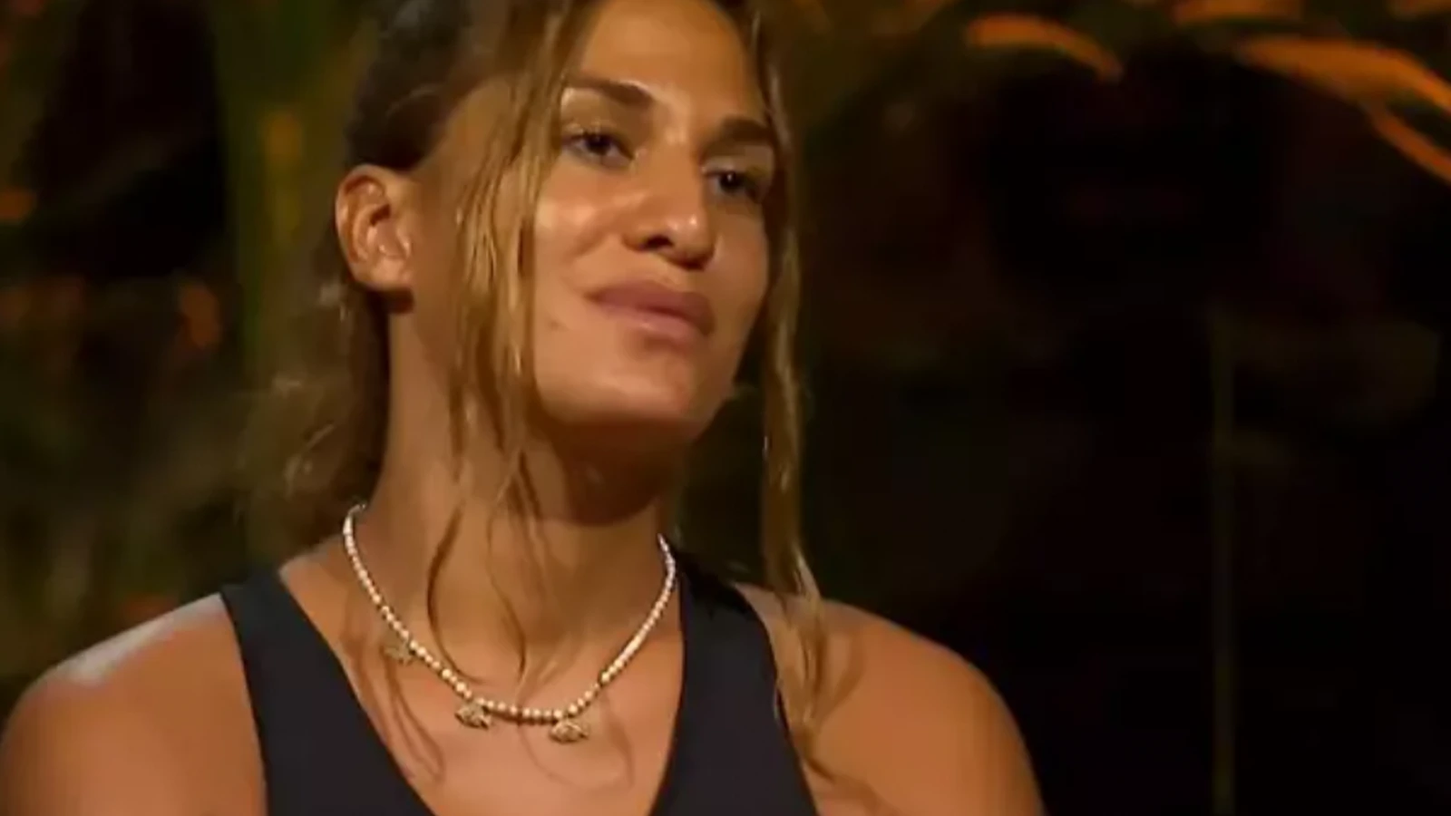 Survivor 2025 yarismacisi Almeda Baylan burun estetigi oldu Iste operasyon sonrasi ilk kare 1