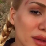 Survivorin eski yarismacisi Almeda Baylan trafik kazasi gecirdi Almeda Baylanin saglik durumu
