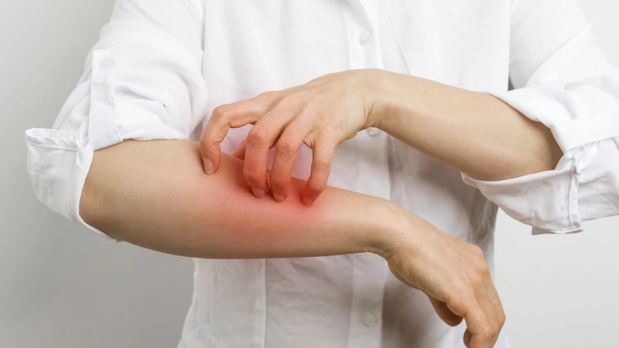 Kış alerjileriyle baş etmenin pratik yolları 2025! 11 Kış alerjileriyle baş etmenin pratik yolları 2025!