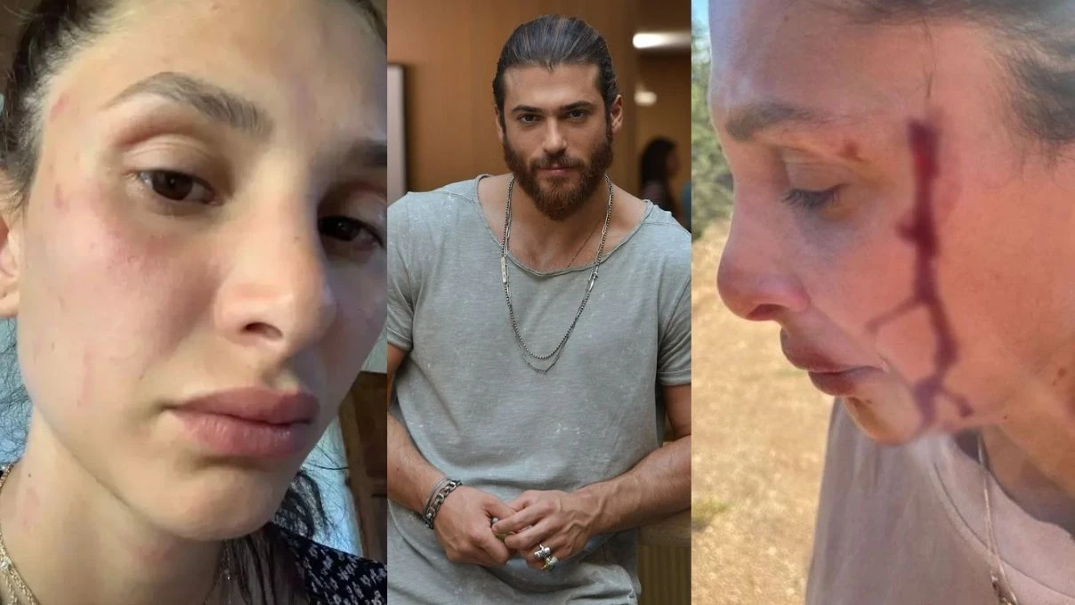 can yaman in sevgilisine ne oldu can yaman in sevgilisini kim dovdu 2